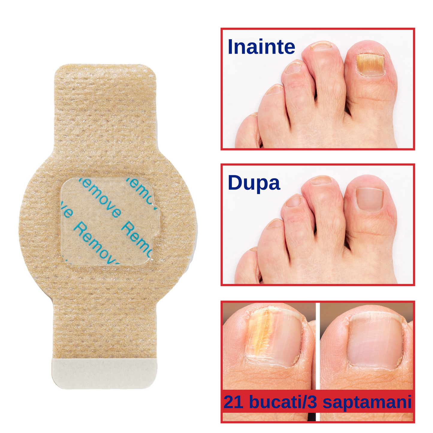 NAIL HELP - Plasturi antifungici pentru unghii