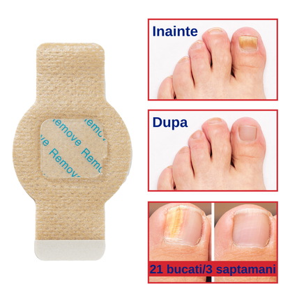 NAIL HELP - Plasturi antifungici pentru unghii