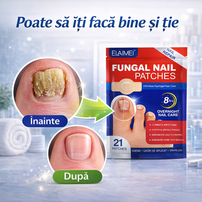 Nail Help - Plasturi Antifungici EFICIENTI